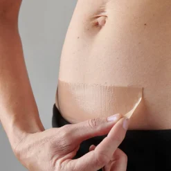 Self-Care|Recovery*Myscar The Original Caesarean Silicone Strips